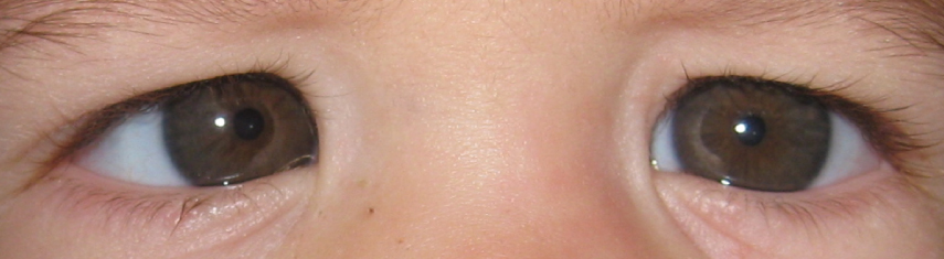 Pediatric Eye Doctor Uws Pediatric Eye Doctor Uws